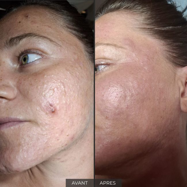 Institut Myskin Genève soin visage