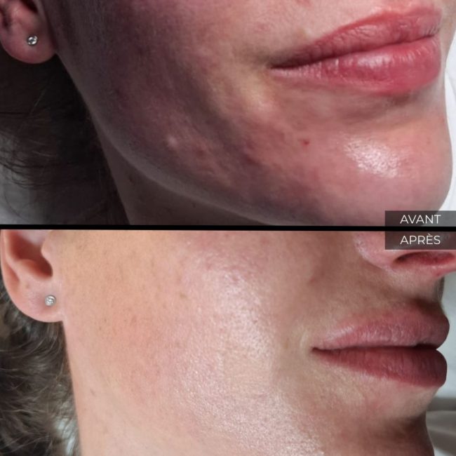 Institut Myskin Genève soin visage