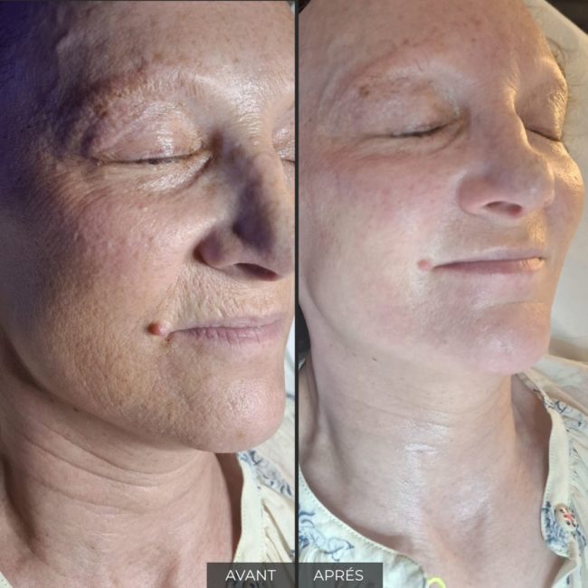 Institut Myskin Genève soin visage