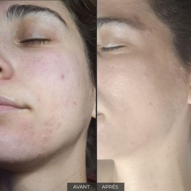 Institut Myskin Genève soin visage